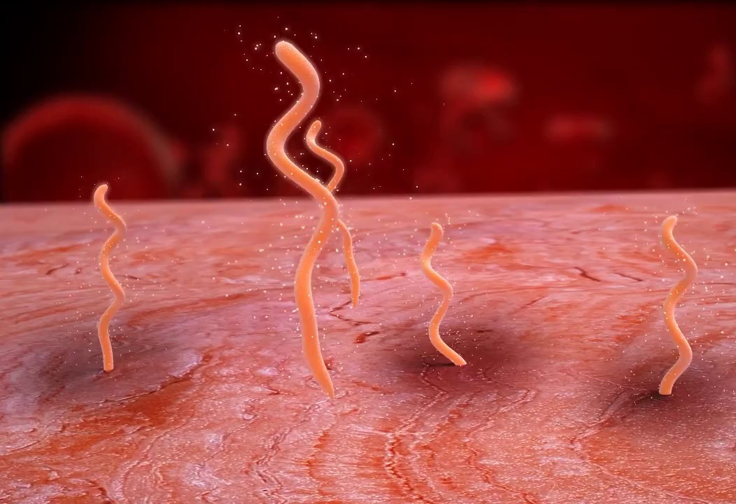   Spirochaetes